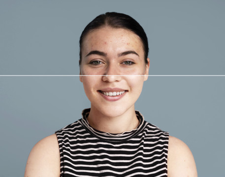 Photo Editing and Enhancement